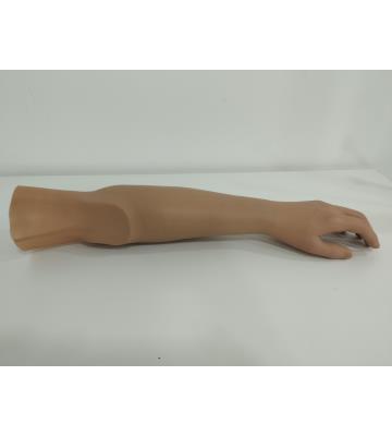 Above elbow Prosthesis